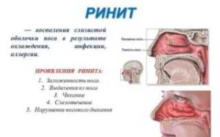 Почему у ребенка постоянный насморк