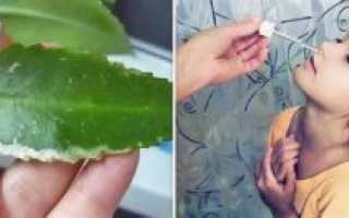 Можно ли капать алоэ в ухо